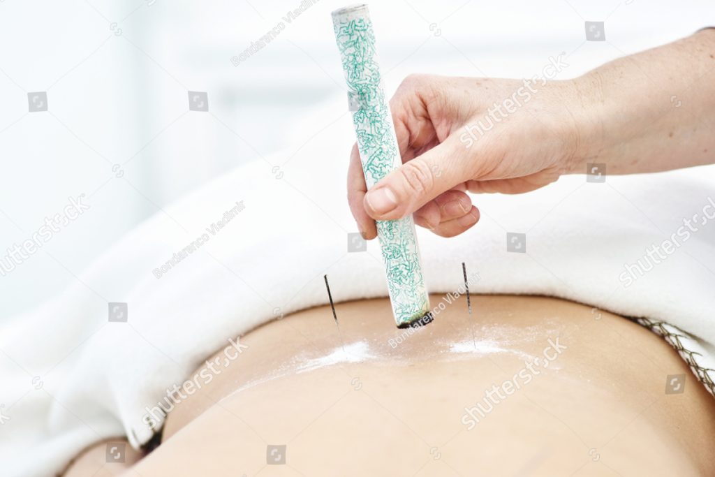 MOXIBUSTION